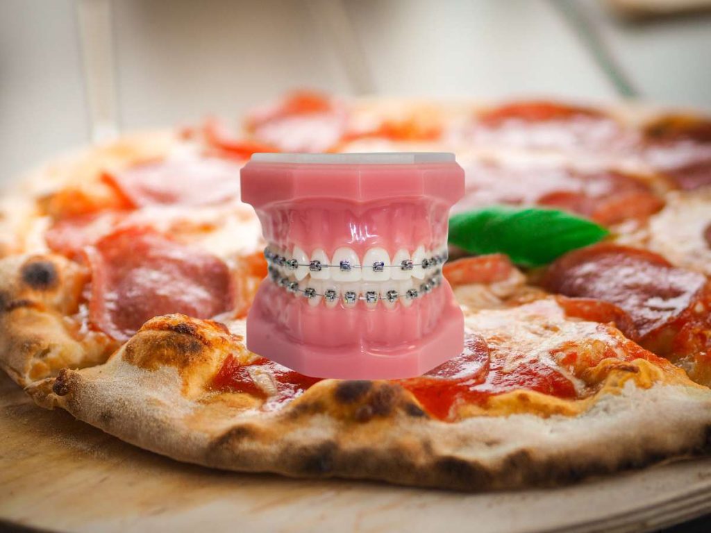 A set of false gums and teeth with braces placed in front of a pizza.